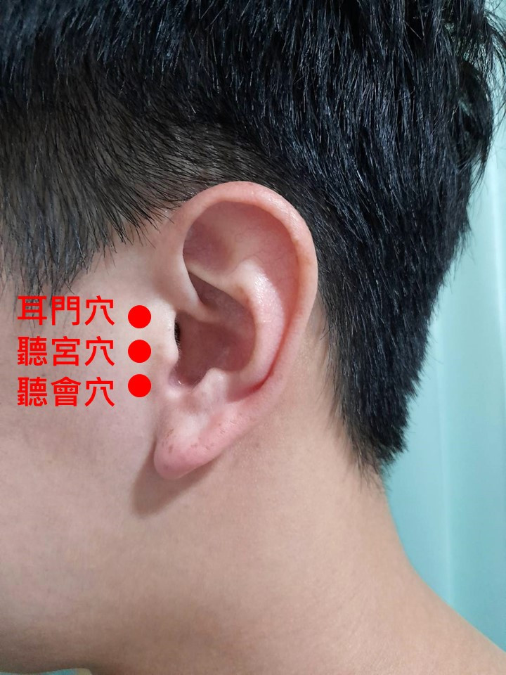 耳順之年耳卻不順　中醫治療減緩耳鳴症狀