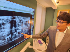 陳俊龍醫師說明牙床牙肉萎縮情形。