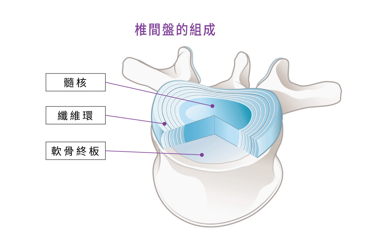 椎間盤由髓核、纖維環及軟骨終板等部份組成。（圖／菁英診所提供）