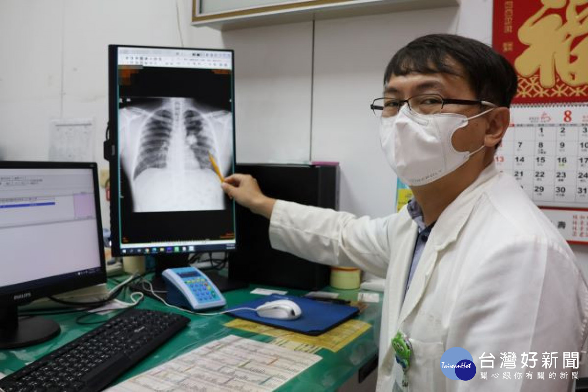 外籍移工抽菸又在粉塵場所工作　健檢揪出罹患肺癌
