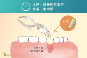 「即拔即植」植牙技術能有效縮短缺牙困窘期。（圖／牙醫師心底話部落格）