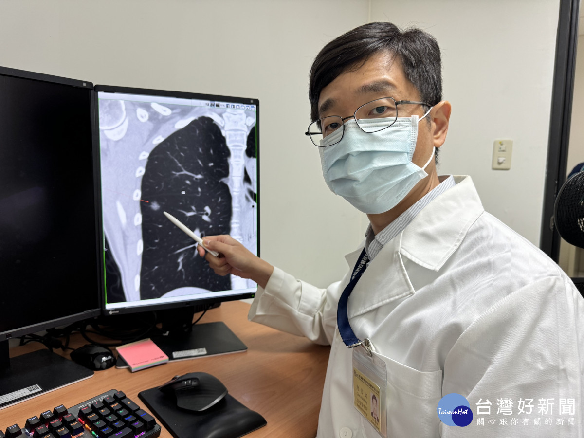 陳信銘醫師表示，病人經由檢查偵測到一顆早期肺癌，呼籲所有肺癌高危險群應定期接受篩檢，才能及早發現、及早治療。