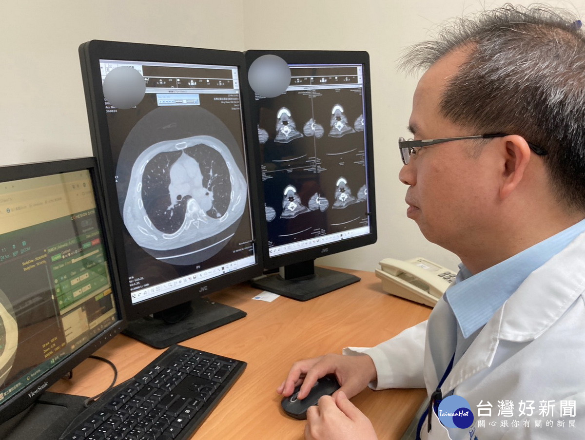 南投醫院低劑量電腦斷層　搭配AI精密判讀揪出肺癌 台灣好新聞 第2張