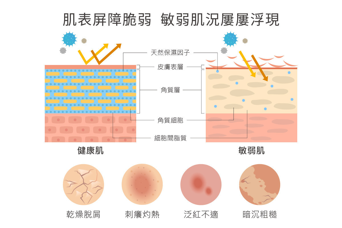 如果肌膚屏障脆弱，則會衍生肌膚乾癢、泛紅等不適問題。（圖／Dr.HUANG生醫團隊）