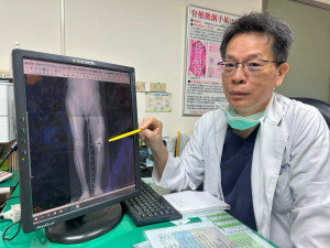 江福財醫師說明靠人工膝關節置換，直接解決患者最在意的長短腳問題。