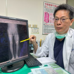 江福財醫師說明靠人工膝關節置換,直接解決患者最在意的長短腳問題。