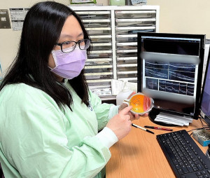 新竹臺大分院眼科部李宜潔醫師提醒，視網膜上增生膜尚無藥物可預防或消除，定期檢查與早期發現是守護視力的關鍵。