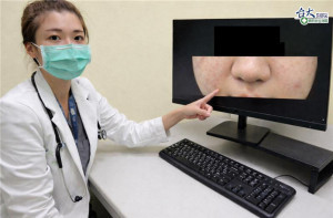 急診醫師石庭慧說明，臉部、嘴唇或眼皮腫脹可能是過敏性休克。