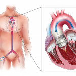 （圖／長庚醫院提供）