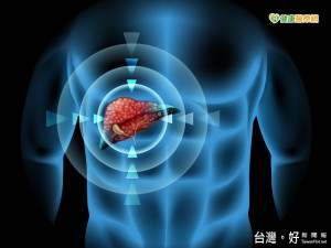 立體定位消融放射治療擺脫肝癌　重獲新生