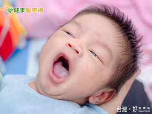 baby身上好多疹子　可能是這些原因...