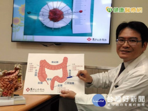 扁平狀息肉癌變機率高　早期大腸癌治療無傷口