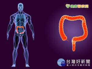 豬哥亮大腸癌拖成末期　「新國病」別輕忽！