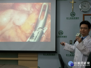 彰基醫院大腸直腸外科主治醫師張譽耀「腸套疊」的診斷圖片。圖／記者鄧富珍攝