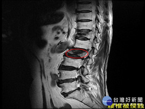 核磁共振影像。林重鎣翻攝