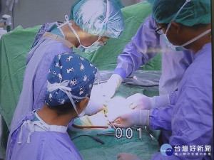 外科主任歐亮宏以「微創腹腔鏡疝氣修補手術」，傷口處僅有3個小傷口，待癒合後不會留有明顯疤痕，且手術後隔天即可出院。（圖／臺北醫院提供）