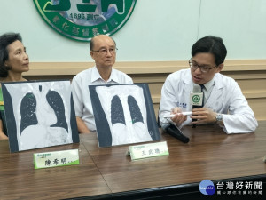 彰基胸腔外科主任王秉彥醫師（右），在複合式手術室中以3D影像單孔胸腔鏡進行手術，清除肺腺癌病灶。