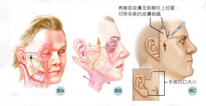 （圖／法喬醫美診所提供）