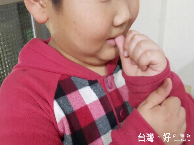 國小童把十根手指頭咬到流血醫師 發洩焦慮感 台灣好新聞taiwanhot Net
