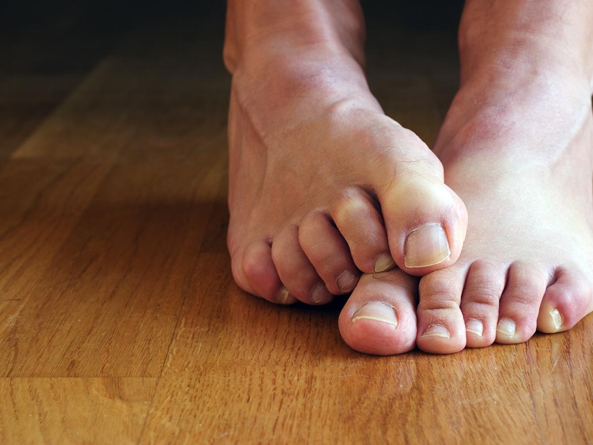 足底筋膜炎讓人寸步難行　增生療法有解？